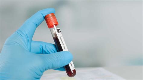 how long is alcohol in blood test